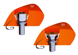 AGRIPP-universal-bolt-insert